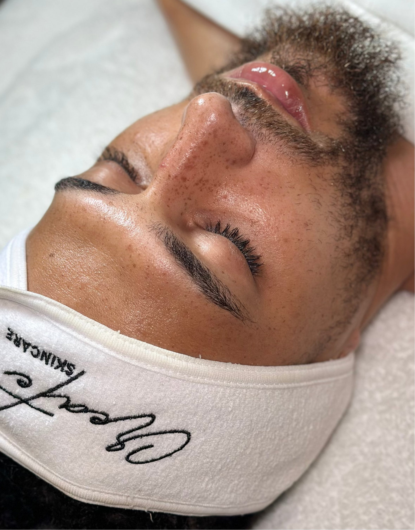 Glass Skin Treatment